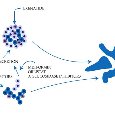 Exenatide