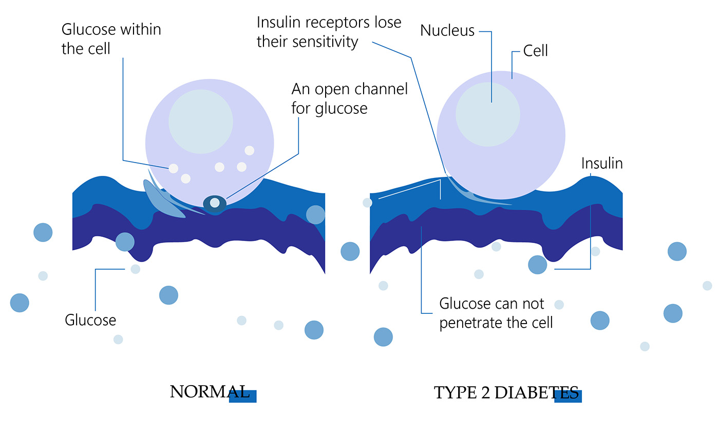 type 2 diabetes betagenon