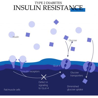 Type 2 diabetes insulin resistance